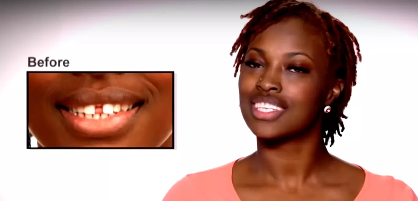 Перфект смайл виниры