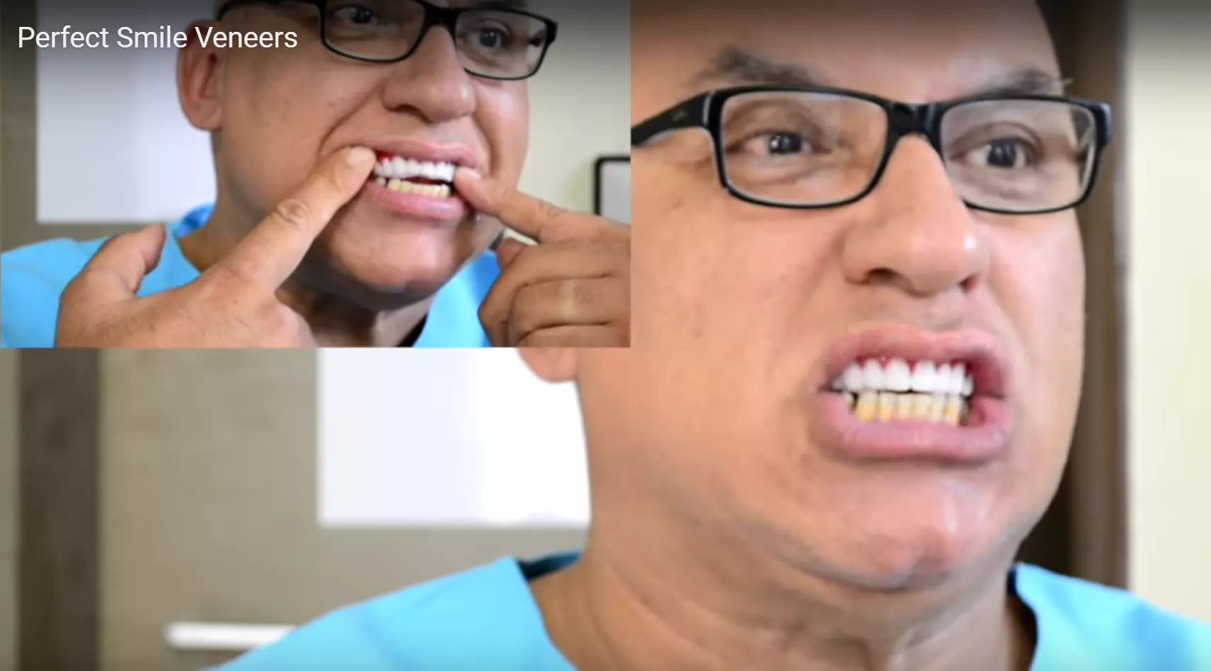Перфект смайл виниры