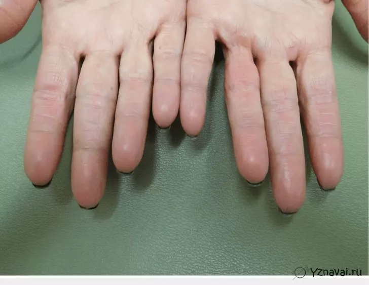 11 фактов об отпечатках пальцев, которые могут заставить вас смотреть на свои руки с большим вниманием